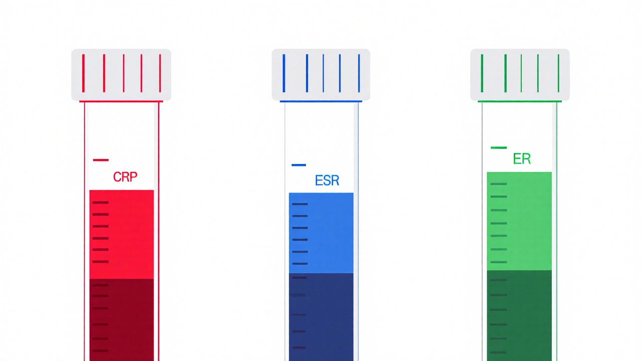 Три сравнительных анализа крови: нормальный, с повышенным СРБ и СОЭ, с высоким прокальцитонином — визуальные маркеры без текста.